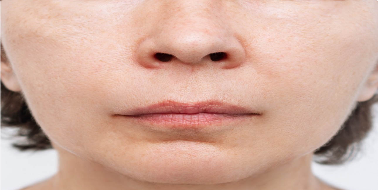 after treatment image