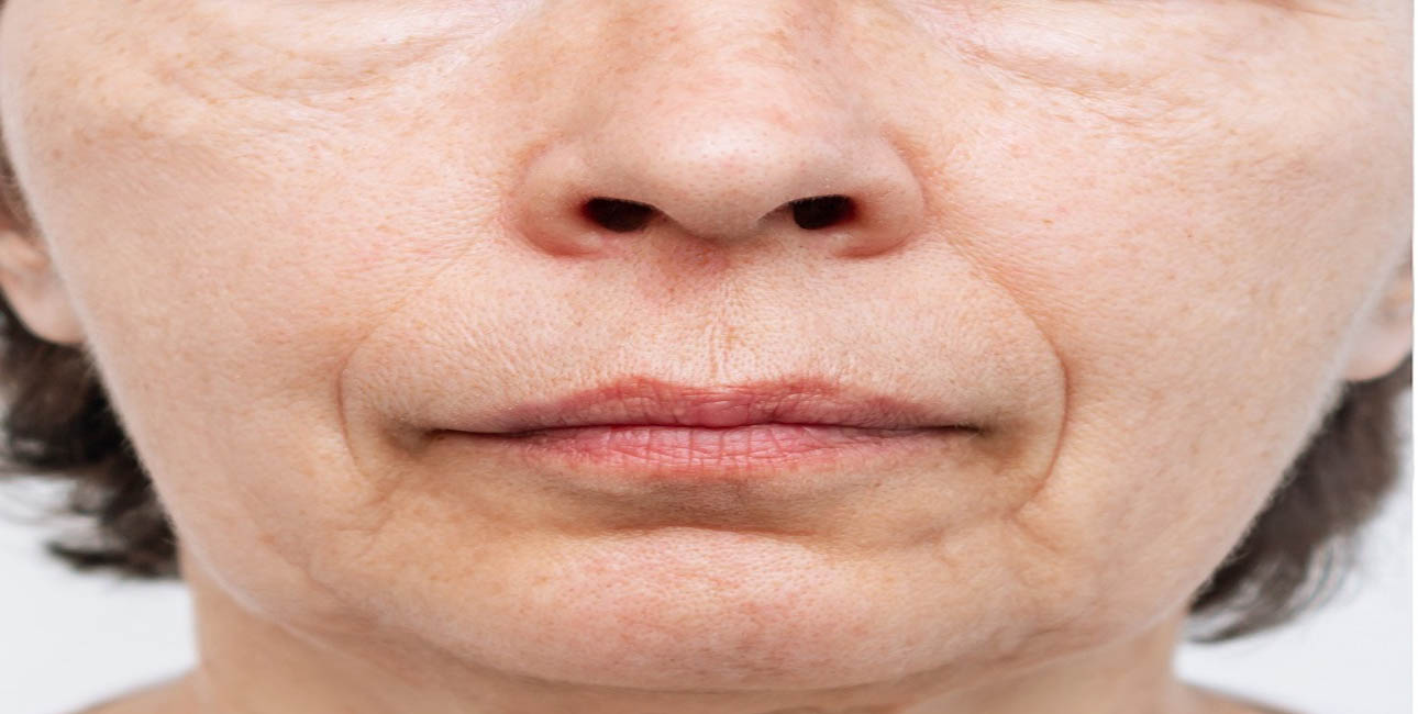 before treatment image